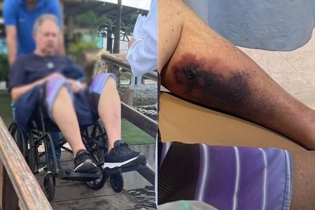 Capa: Turista morre após ser picado por aranha em Morro de São Paulo