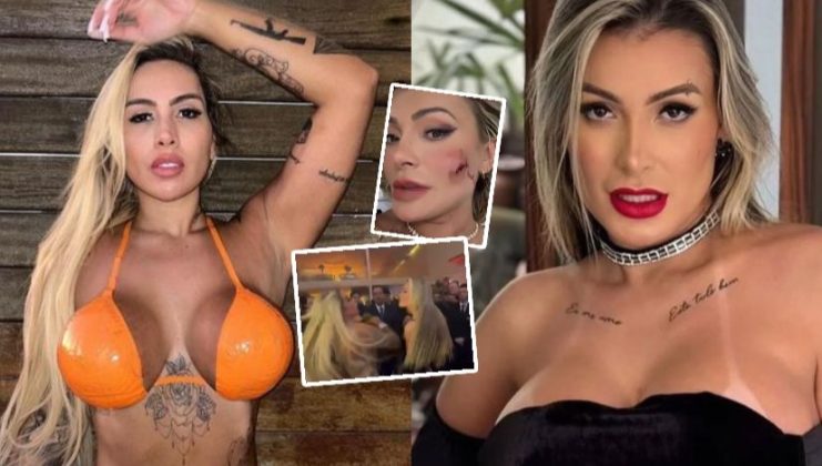 Capa: Andressa Urach leva pontos no rosto após nova briga com Juju Ferrari